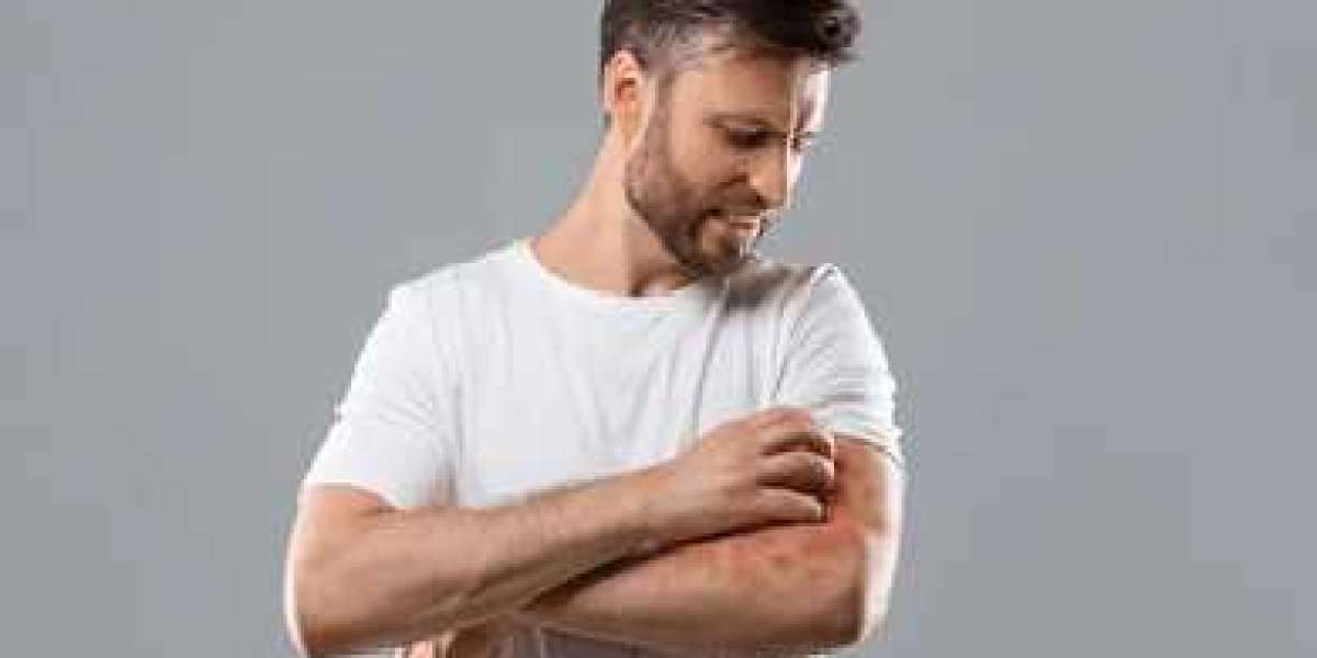 Article Picture