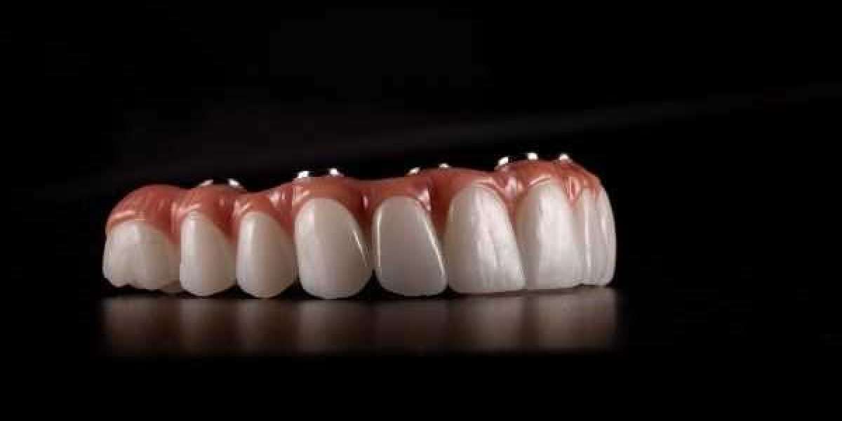 Expert Implant Dentistry Functional Aesthetic Lasting