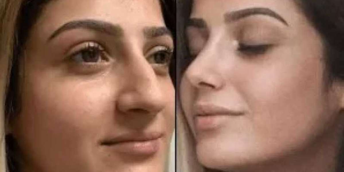 Transform Your Look at the Best Aesthetic Clinic in Dubai