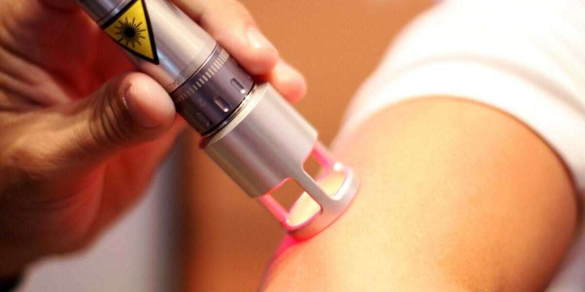 Laser Therapy Market Trends: Innovations and Future Outlook