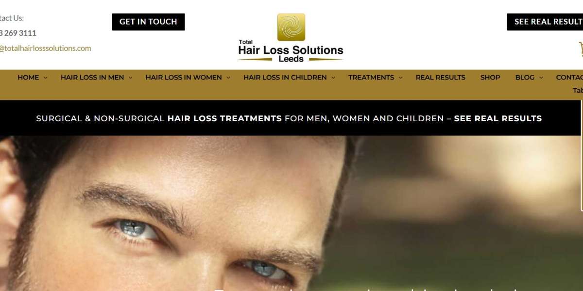 Thinning Hair for Women in Yorkshire – Causes, Treatments, and Solutions
