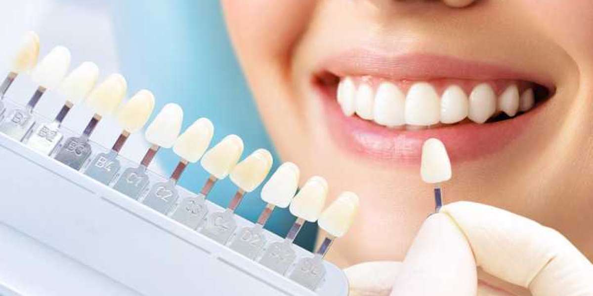Cosmetic Dentist Dubai | Hollywood Smile Makeover