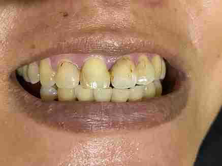 Image Source - Private Dentist Cardiff