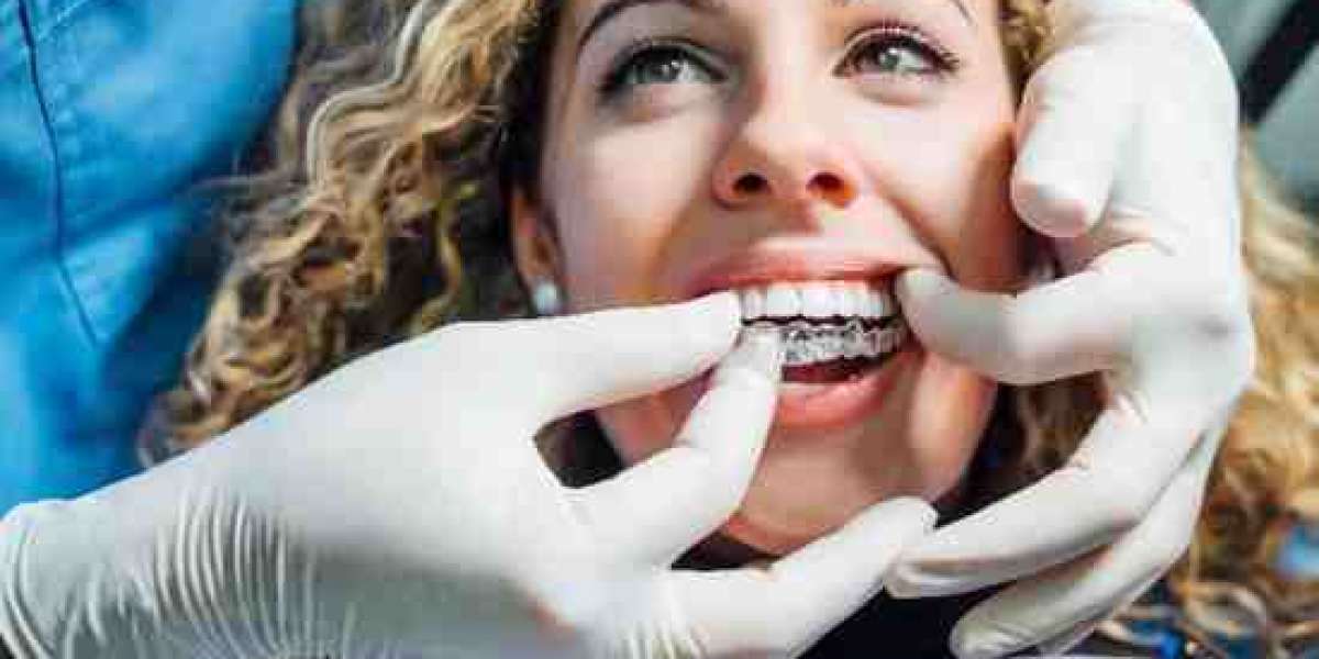 Emotional and Psychological Perk of Achieving a Straighter Smile